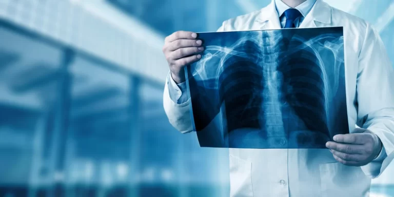 xray-radiology-doctor-hospital-disease-radiography-ray