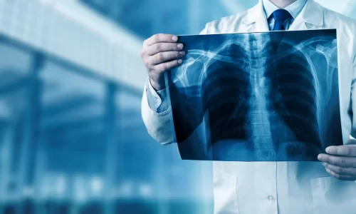 xray-radiology-doctor-hospital-disease-radiography-ray